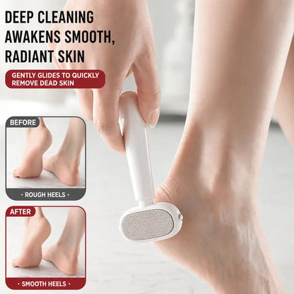 🦶 49% OFF 2-in-1 Foot Callus Remover – Scrape & Smooth Rough Heels ✨
